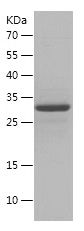    KAAG1 / Recombinant Human KAAG1