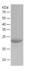    eIF3K / Recombinant Human eIF3K