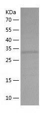    MRG15 / Recombinant Human MRG15