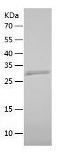    CNOT8 / Recombinant Human CNOT8