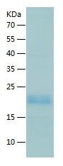    IL-17B / Recombinant Human IL-17B