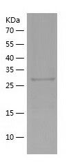    CYB5R1 / Recombinant Human CYB5R1