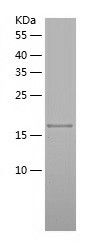    DUSP13 / Recombinant Human DUSP13