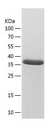    NAGK / Recombinant Human NAGK