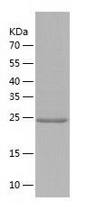    Dnmt3L / Recombinant Human Dnmt3L