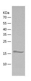    ADAM21 / Recombinant Human ADAM21