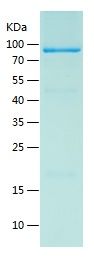    ZNFN1A2 / Recombinant Human ZNFN1A2