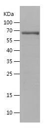    MA2 / Recombinant Human MA2