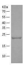    PSME2 / Recombinant Human PSME2