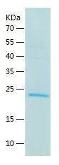    Endomucin / Recombinant Human Endomucin