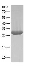    Carbonic Anhydrase 14 / Recombinant Human Carbonic Anhydrase 14