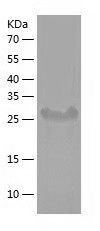    STAP-1 / Recombinant Human STAP-1