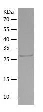 Recombinant Mouse SFRP5