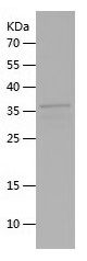 Recombinant Mouse Wnt8b