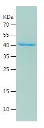    ENTPD4 / Recombinant Human ENTPD4