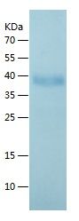    SCGF / Recombinant Human SCGF