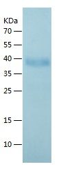    SCGF / Recombinant Human SCGF