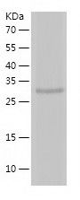    SUGT1 / Recombinant Human SUGT1