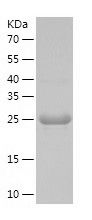    UBC6e / Recombinant Human UBC6e