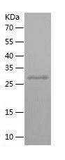    ZNF337 / Recombinant Human ZNF337