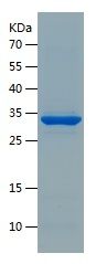    MMACHC / Recombinant Human MMACHC