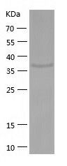    PME-1 / Recombinant Human PME-1