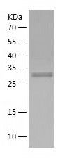    UCH37 / Recombinant Human UCH37