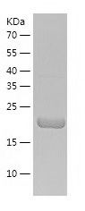    HEMK2 / Recombinant Human HEMK2