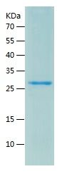    MAGED1 / Recombinant Human MAGED1