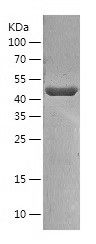    SNX5 / Recombinant Human SNX5