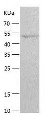    SIRT4 / Recombinant Human SIRT4