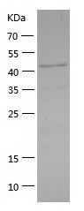    IKK gamma / Recombinant Human IKK gamma