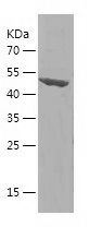    CPS1 / Recombinant Human CPS1