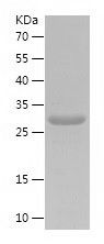    UCHL3 / Recombinant Human UCHL3