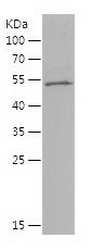    PRKCB / Recombinant Human PRKCB