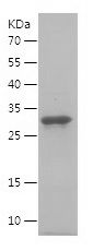    TWIST2 / Recombinant Human TWIST2