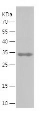    STX3 / Recombinant Human STX3