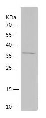    TBX3 / Recombinant Human TBX3