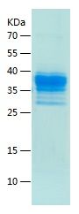    CGAS / Recombinant Human CGAS