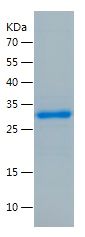    SCN9A / Recombinant Human SCN9A