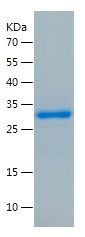    SCN9A / Recombinant Human SCN9A