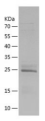    RAB3D / Recombinant Human RAB3D