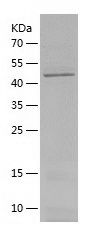    PRKDC / Recombinant Human PRKDC