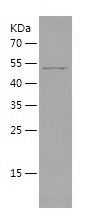    SIRT4 / Recombinant Human SIRT4