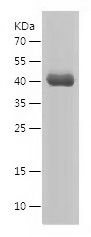    ZNF238 / Recombinant Human ZNF238