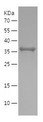    ATP5D / Recombinant Human ATP5D