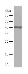    ALDH1A3 / Recombinant Human ALDH1A3