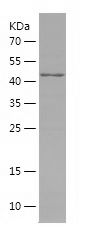    ALDH1B1 / Recombinant Human ALDH1B1