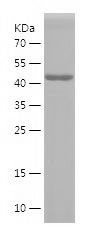    TMOD1 / Recombinant Human TMOD1