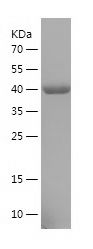    ALDOC / Recombinant Human ALDOC